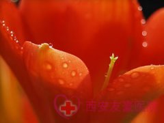 治疗性病要注意什么呢